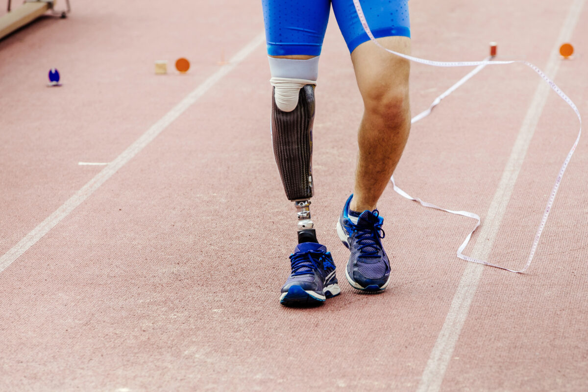 What Are the Long-Term Costs of Amputation or Disfigurement After an Accident